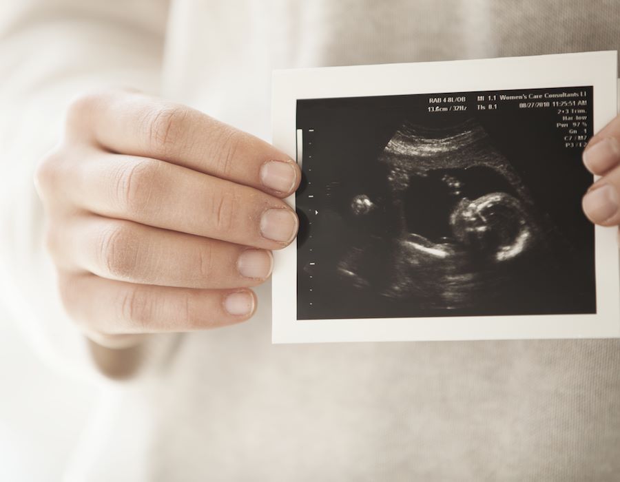 Americans’ Opinions on Abortion Holding Steady