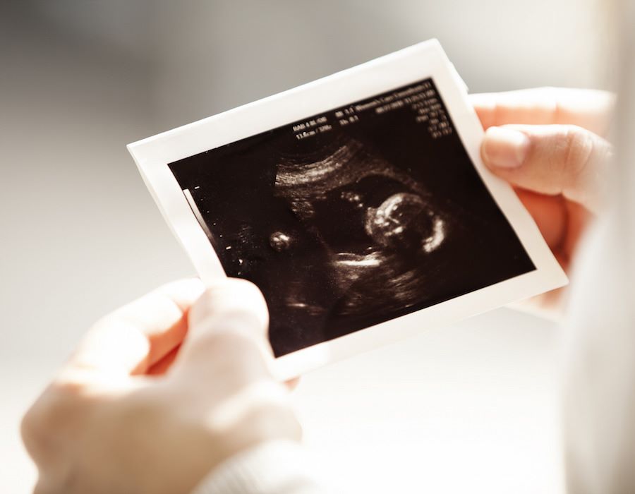 After Video Leak, Planned Parenthood Undergoes Investigation